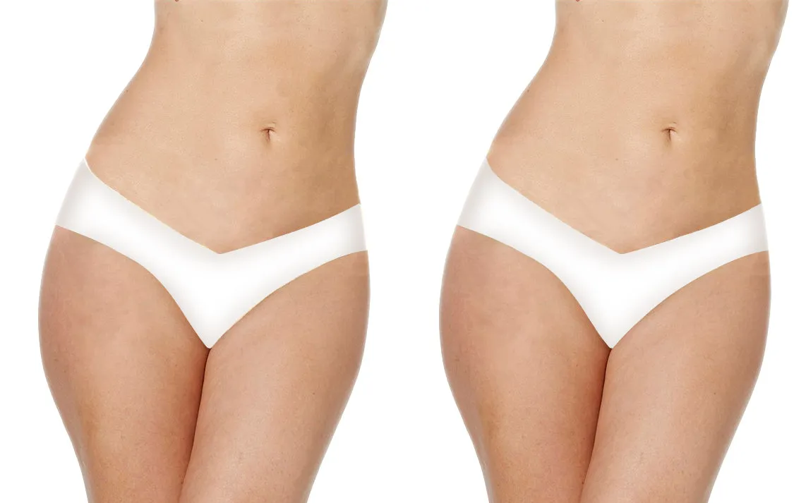 Alessandra B 2 Pack Camel Toe Cover Thong - M7711-2